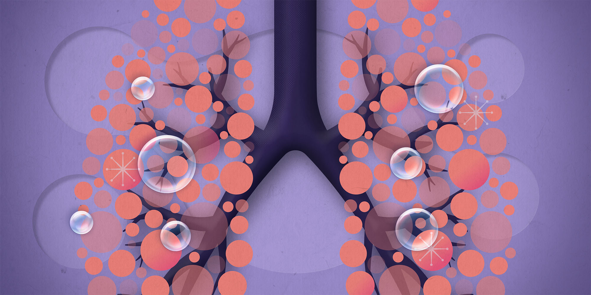 The management of community-acquired pneumonia