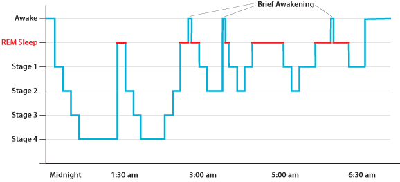 Figure 1: Human sleep architecture